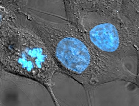 File:HeLa cells stained with Hoechst 33258.jpg